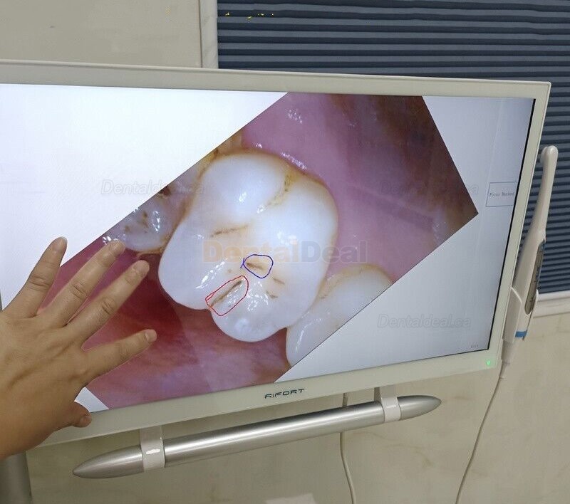 Magenta YF-2200P+ 21.5 Inch Touch Screen Intraoral Camera VGA+HDMI